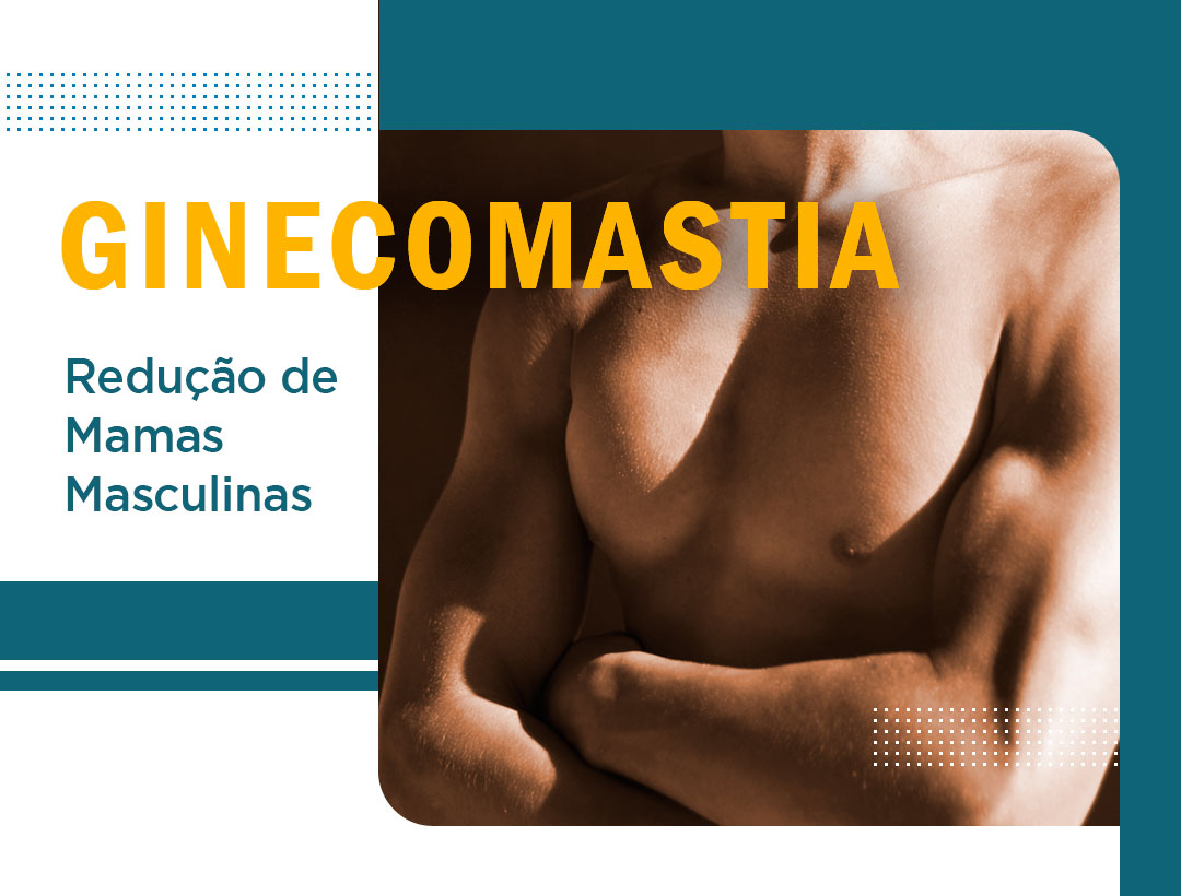 Ginecomastia - Dr Carlos Neumann